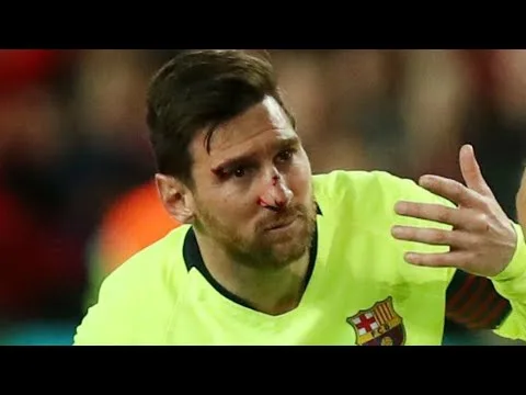2 Times Leo Messi Bleeding by Brutal Foul