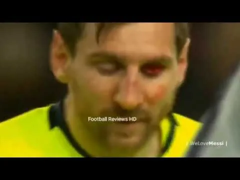 Leo Messi Sad Moments-  2020